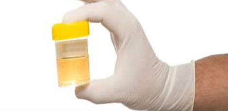Tempi di smaltimento del THC nelle urine